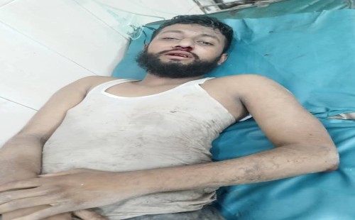 গাজীপুরে সাংবাদিক আনোয়ার হোসেনের উপর সন্ত্রাসী হামলা, – বিআইআরসি'র তীব্র নিন্দা